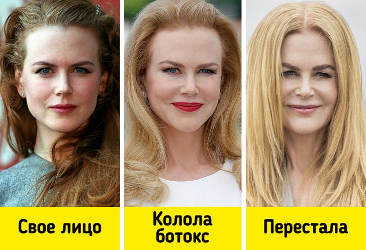 Звёзды, которые попробовали перекроить внешность, а теперь шарахаются от подобных процедур как от огня