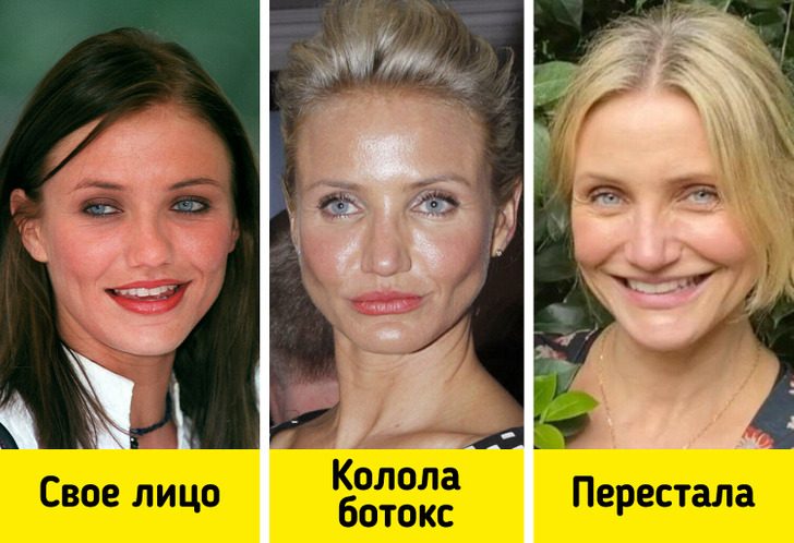 Звёзды, которые попробовали перекроить внешность, а теперь шарахаются от подобных процедур как от огня