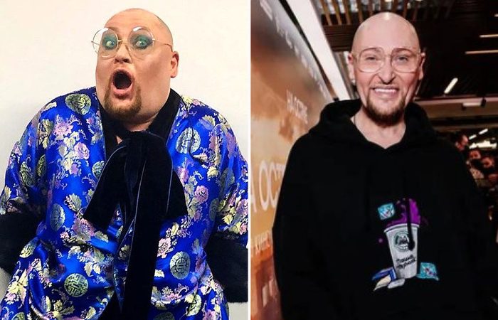 На что идут звёзды в погоне за красотой