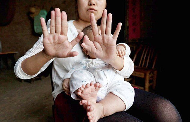У китайской семьи родился мальчик с 31 пальцем
