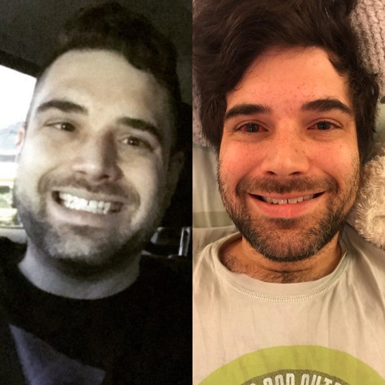 Стас костюшкин пластика лица до и после фото