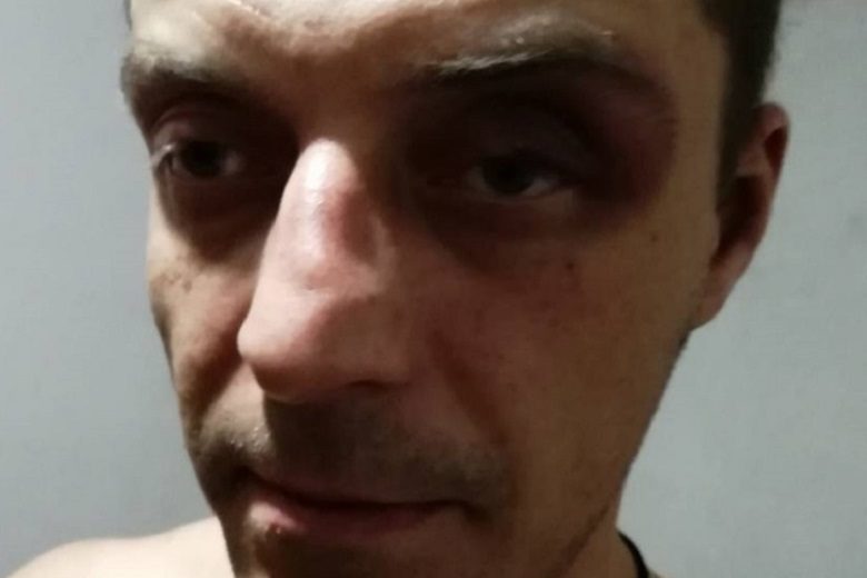 На Урале задержанный рассказал об пытках в полиции