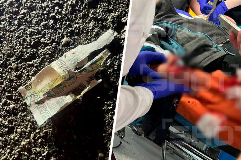 Школьнику в Красногорске разорвало руку при попытке поднять деньги. «Идет СВО, возможны провокации»