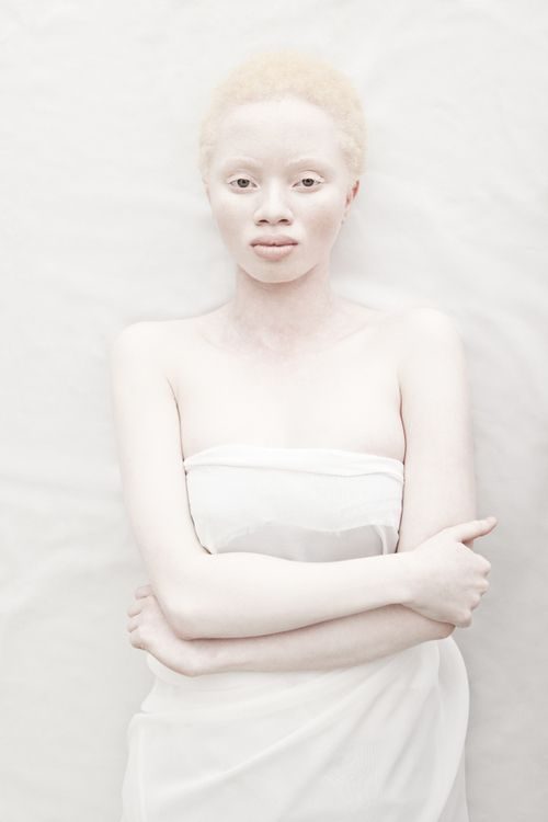 Снежная красота: удивительные альбиносы из разных стран мира