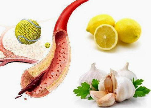 8 лучших продуктов для чистки сосудов! / Будьте здоровы